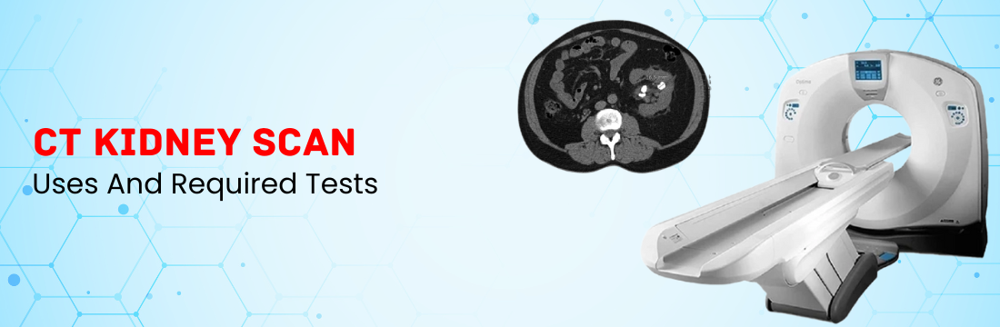 CT Kidney Scan Uses And Required Tests